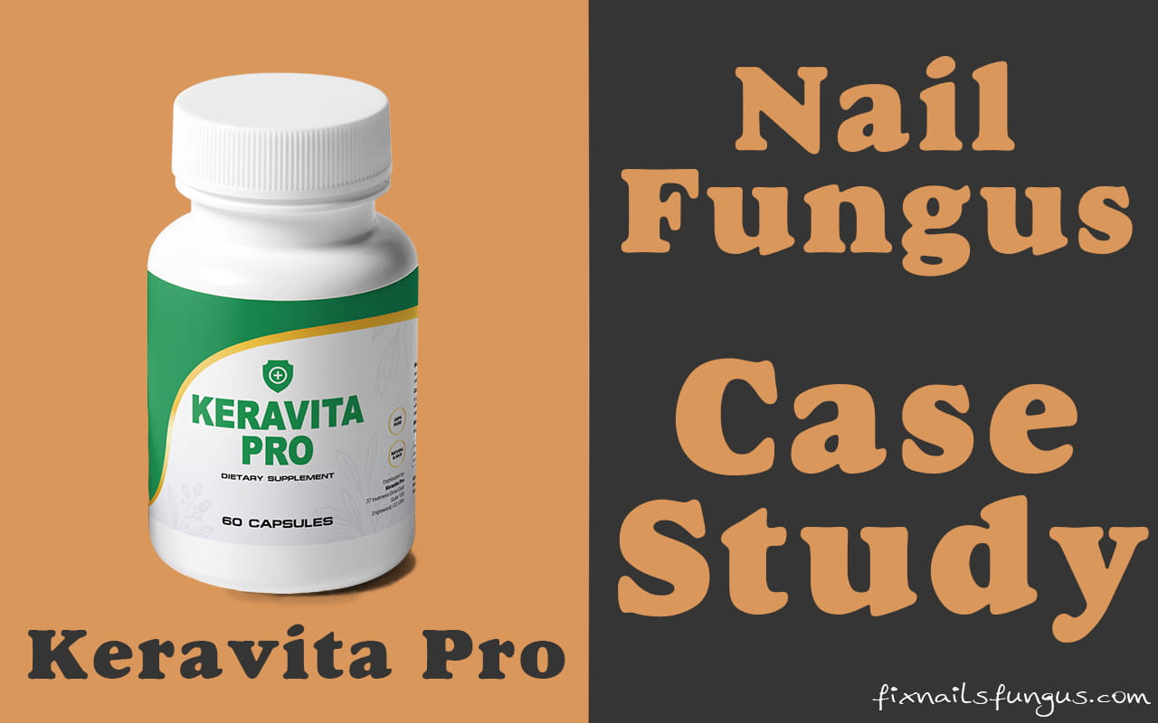 Keravita pro case study for toenail fungus Keravita pro case study for toenail fungus